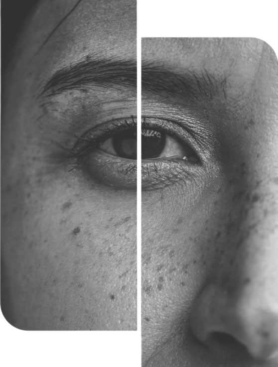 eye